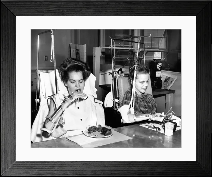 Framed Print : Two young women in rehabilitation after polio. They were both in Iron Lungs and are now feeding themselves with the help of special equipment