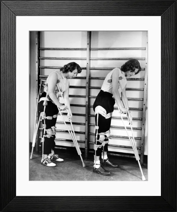 Framed Print : Two adult women polio victims with leg braces adjust their crutches Framed Print : Two adult women polio victims with leg braces adjust their crutches