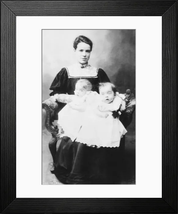 Framed Print : Daisy Hilton and Violet Hilton, conjoined twins, at age 18 months. Their mother was Kate Skinner, an unmarried barmaid. The women holding the twins is possibly Mary Hilton