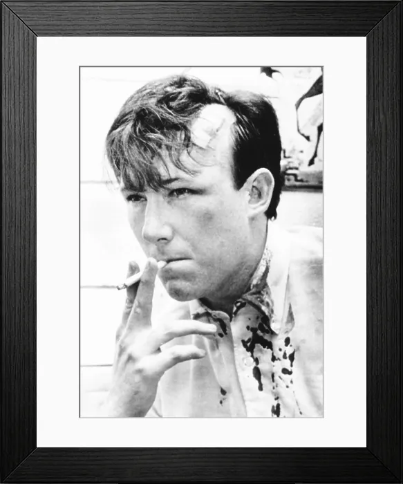 Framed Print : Washington Post reporter Jim Hoagland was beaten at South Carolina State College. Feb.10, 1968