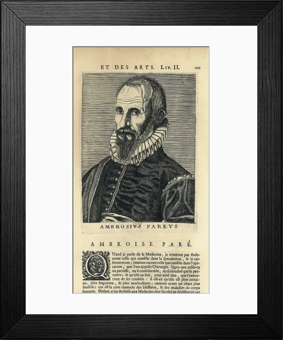 Framed Print : PARE, Ambroise (1509-1590). Xylography. FRANCE. Paris. National Library. AISA / Everett Collection**US SALES ONLY** Framed Print : PARE, Ambroise (1509-1590). Xylography. FRANCE. Paris. National Library. AISA / Everett Collection**US SALES ONLY**