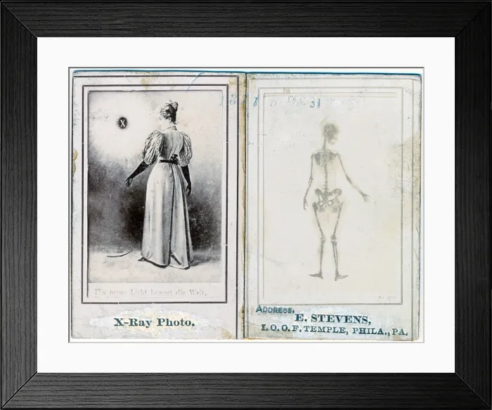 Framed Print : Two views of a woman, clothed, and as an X-ray, Temple, Philadelphia, Pennsylvania, by E. Stevens, circa 1890s