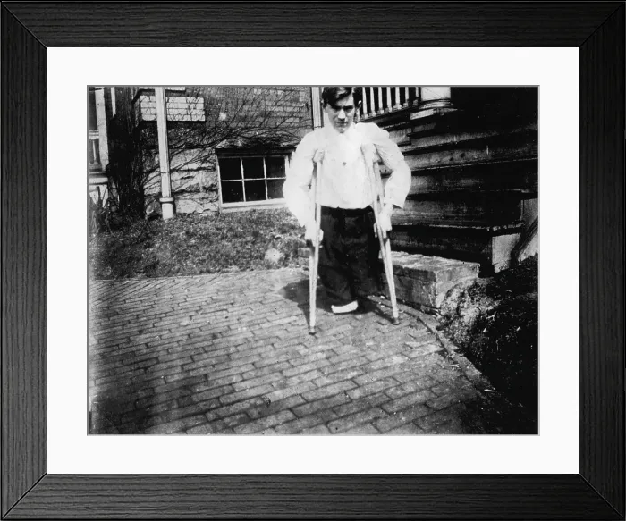 Framed Print : Child labor, Frank P. legs were cut off by a motor car in a coal mine when he was 14 years of age, Monongah, West Virginia, photograph by Lewis Wickes Hine, March, 1910