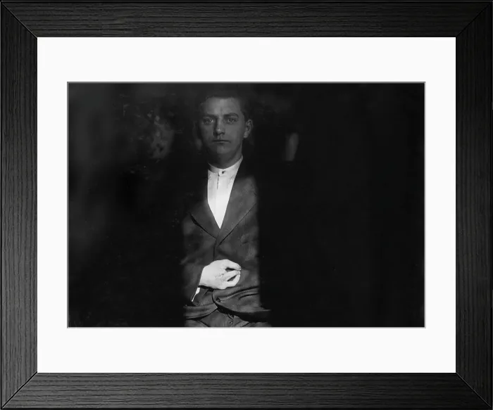 Framed Print : Child labor, Frank Wiegel, of Brooklyn, injured after working 18 hours a day at 15 years old, two fingers were amputated off of his right hand