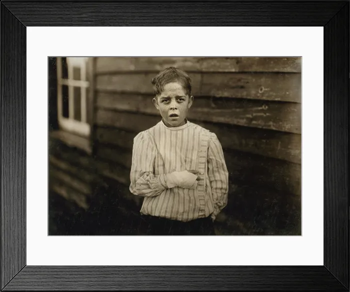 Framed Print : Child Labor, Giles Edmund Newsom, while working in Sanders spinning mill, a piece of the machine fell onto his foot mashing his toe, causing him to fall to a spinning machine