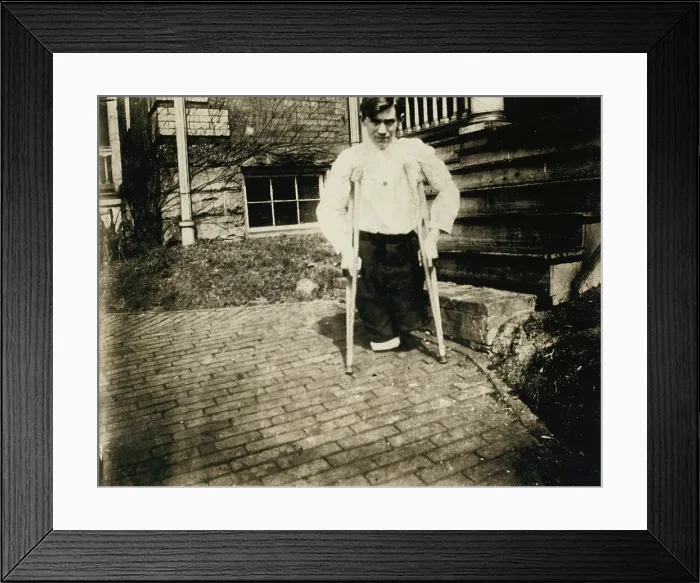 Framed Print : Child Labor, Frank, whose legs were cut off by a motor car in a coal mine in West Virginia when he was 14 years, 10 months of age, West Virginia, photograph by Lewis Wickes Hine