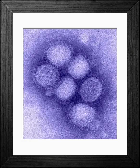 Framed Print : Swine flu virus. Negative stained transmission electron micrograph. Photo by C. S. Goldsmith and A. Balish, 2009