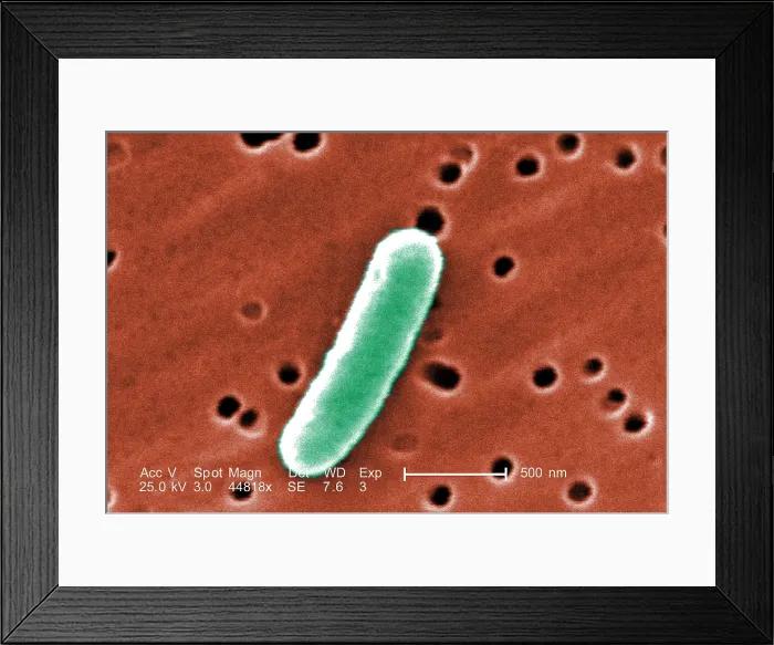 Framed Print : E. coli, a common cause of bacterial diarrhea. Colorized scanning electron micrograph (SEM). Photo by Janice Haney Carr, 2007