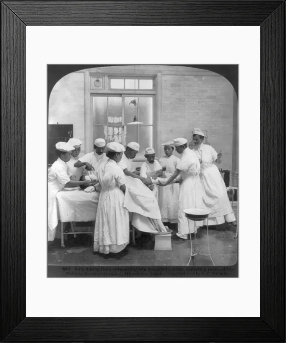 Framed Print : Japan, Amputating the shattered leg of a wounded soldier, operating room the Military Reserve Hospital, Hiroshima, photograph 1905 Framed Print : Japan, Amputating the shattered leg of a wounded soldier, operating room the Military Reserve Hospital, Hiroshima, photograph 1905