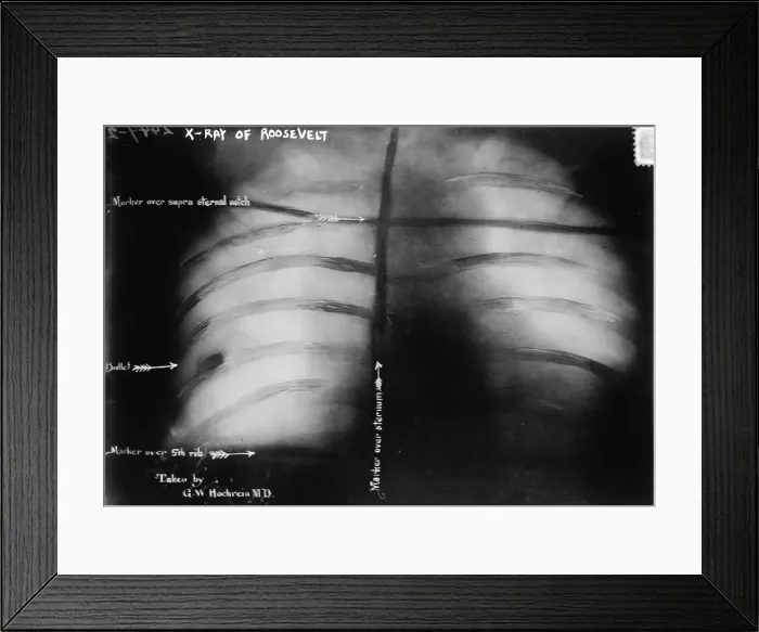 Framed Print : During Theodore Roosevelt's third party, 'Bull Moose, ' campaign in Wisconsin 1912, he was shot in the chest with.38 caliber pistol by John Schrank Framed Print : During Theodore Roosevelt's third party, 'Bull Moose, ' campaign in Wisconsin 1912, he was shot in the chest with.38 caliber pistol by John Schrank