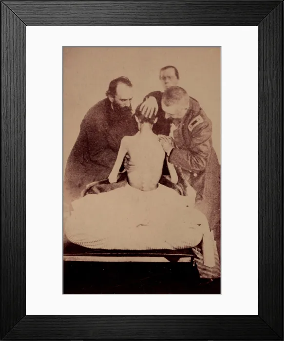 Framed Print : The Civil War, Doctors examining a Federal prisoner returned from prison, photograph circa 1861-1865