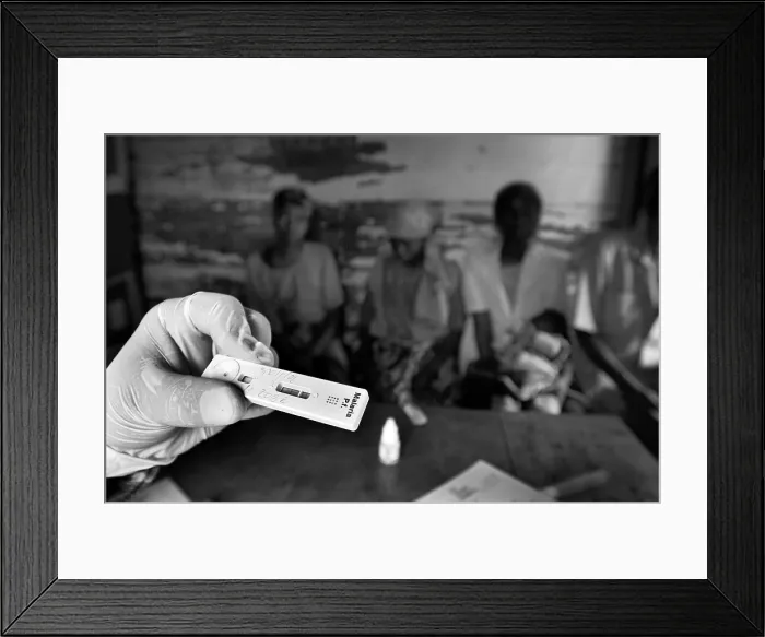 Framed Print : CONGO, Democratic Republic of the. NORTH KIVU. Democratic Republic of the Congo (2008). Kivu Conflict. Parachek fast test of malaria detection Framed Print : CONGO, Democratic Republic of the. NORTH KIVU. Democratic Republic of the Congo (2008). Kivu Conflict. Parachek fast test of malaria detection