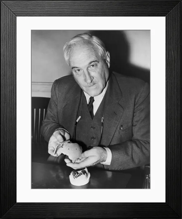 Framed Print : Dr. Louis Leakey (1903-1972), Kenyan archaeologist holding pieces of 600, 000 year-old human skull