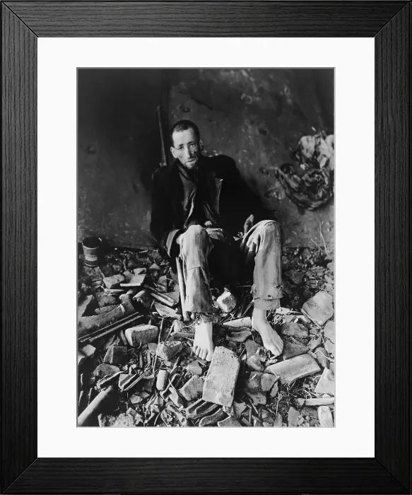 Framed Print : French prisoner at Nordhausen Concentration camp amid prison rubble waiting for an ambulance to take him to a hospital after liberation by First U.S. Army on April 11, 1945