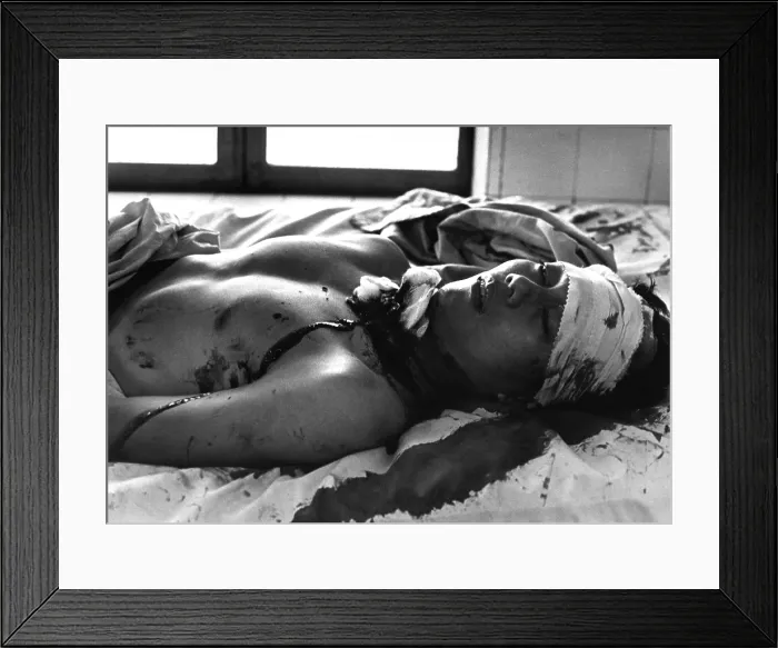 Framed Print : Vietnam War. One of 48 persons wounded by a Viet Cong explosion which killed 14 persons in Saigon awaits treatment in the Cong Hoa Hospital Framed Print : Vietnam War. One of 48 persons wounded by a Viet Cong explosion which killed 14 persons in Saigon awaits treatment in the Cong Hoa Hospital