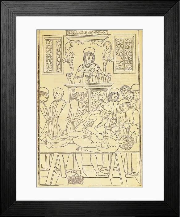 Framed Print : KETHAM, Johannes de (second half 15th century-begin 16th). German physician living in Italy at the end of the fifteenth century