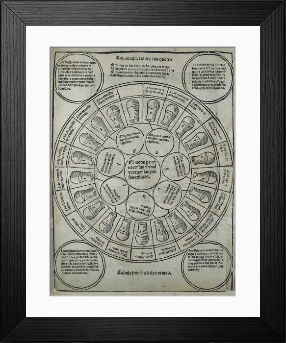 Framed Print : KETHAM, Johannes de (second half 15th century-begin 16th). German physician living in Italy at the end of the fifteenth century