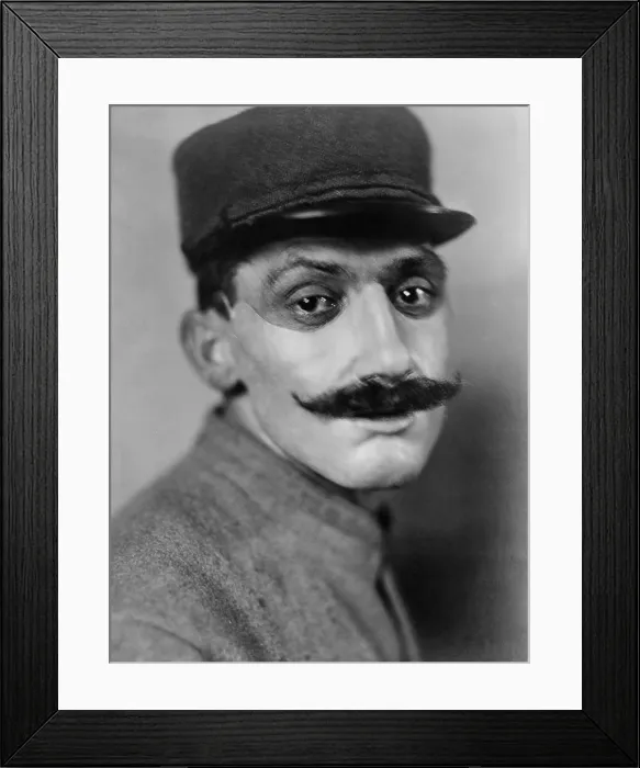 Framed Print : World War 1. French soldier, whose face was disfigured in World War I, wearing a mask of sculpted and painted copper made by American artist Anna Coleman Ladd. July 1918 Framed Print : World War 1. French soldier, whose face was disfigured in World War I, wearing a mask of sculpted and painted copper made by American artist Anna Coleman Ladd. July 1918