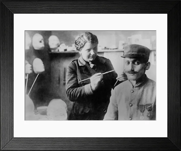 Framed Print : Disfigured WW1 Veteran's mask gets finishing touches by sculptor Anna Ladd. 1918