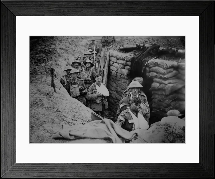 Framed Print : Bandaged British World War 1 soldiers in a battlefield trench, 1915-1918. (BSLOC_2012_4_65) Framed Print : Bandaged British World War 1 soldiers in a battlefield trench, 1915-1918. (BSLOC_2012_4_65)