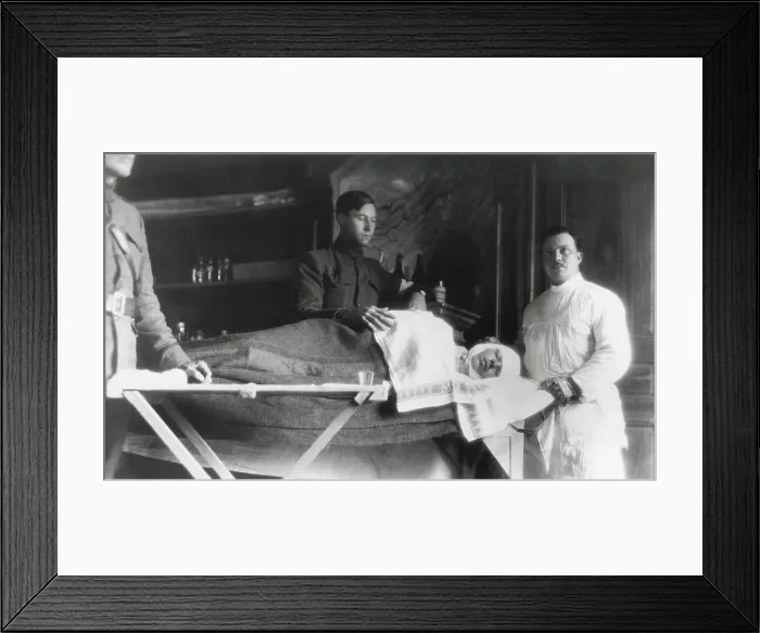 Framed Print : American WW1 Soldier with a head wound in U.S. Base hospital, France. 1917-18. (BSLOC_2012_4_64) Framed Print : American WW1 Soldier with a head wound in U.S. Base hospital, France. 1917-18. (BSLOC_2012_4_64)