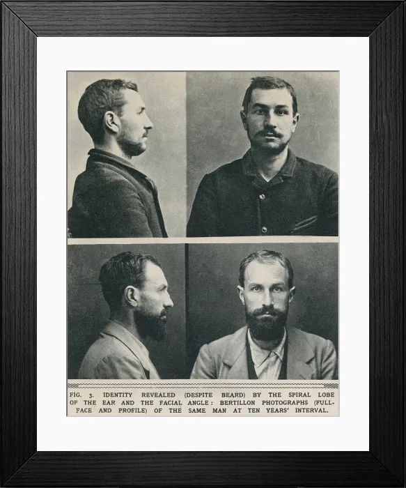 Framed Print : Bertillon system photographs taken at a ten year's interval, reveal it is the same man by the spiral lobe of the ear and the facial angle Framed Print : Bertillon system photographs taken at a ten year's interval, reveal it is the same man by the spiral lobe of the ear and the facial angle