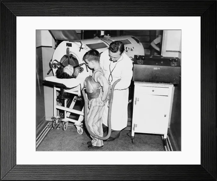 Framed Print : At the height of a polio epidemic, Dr. Harry Seanor, fastens the one pound lung on an eight year old boy, to show the difference in size to that of the 700 pound lung at left