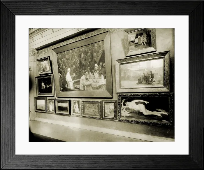 Framed Print : Thomas Eakin's monumental realist painting, THE AGNEW CLINIC (1889) is prominently displayed at the 1893 Columbian Exposition, in Chicago