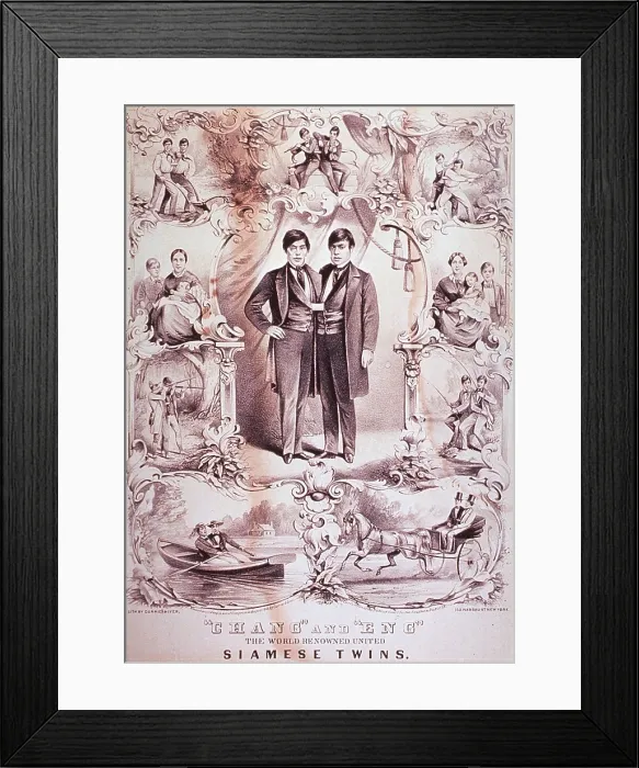Framed Print : Chang and Eng, (1811-1874), World Renowned United Siamese Twins Framed Print : Chang and Eng, (1811-1874), World Renowned United Siamese Twins