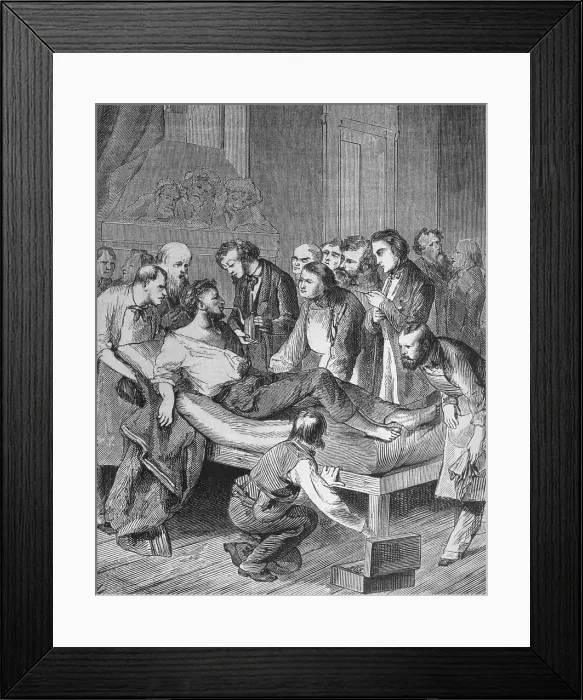 Framed Print : First administration of ether to a patient, Gilbert Abbott, about to undergo surgery for a tumor in the neck at Massachusetts General Hospital on October 16, 1846 Framed Print : First administration of ether to a patient, Gilbert Abbott, about to undergo surgery for a tumor in the neck at Massachusetts General Hospital on October 16, 1846