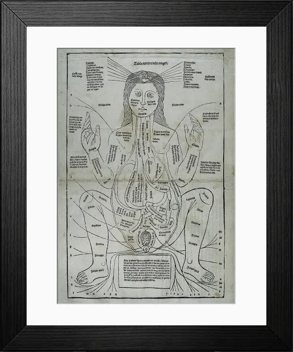 Framed Print : KETHAM, Johannes de (second half 15th century-begin 16th). German physician living in Italy at the end of the fifteenth century