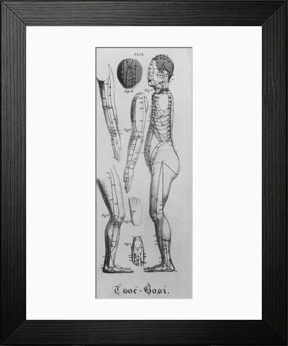 Framed Print : Human figure shown in left profile with acupuncture points and meridians identified. Also shown are views of the head, the arms, legs, and the top and bottom of a foot