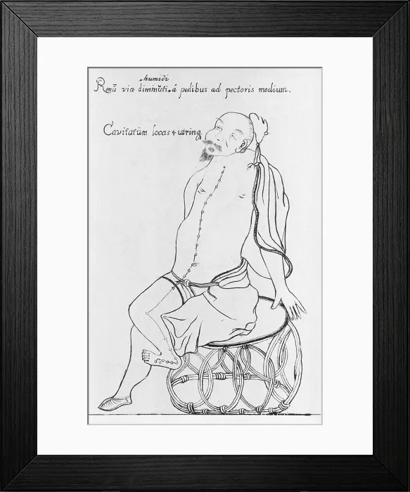 Framed Print : Acupuncture points for treatment of kidney disorders on a seated, bearded Oriental man