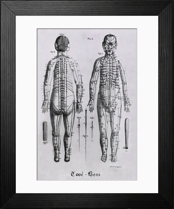 Framed Print : Front and back views of a human figure with numerous acupuncture points and meridians identified. Between the figures, but not to scale, are three acupuncture needles