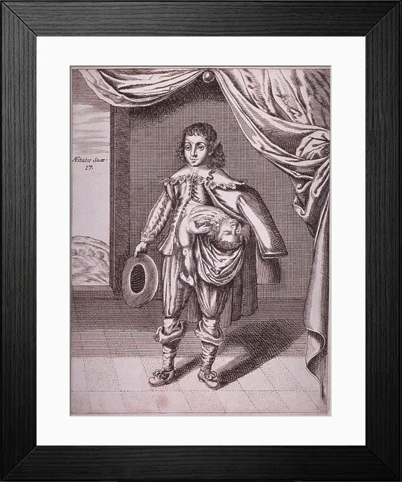 Framed Print : Boy with a deformity caused by a partial conjoined twin growing from his side. 1686 engraving