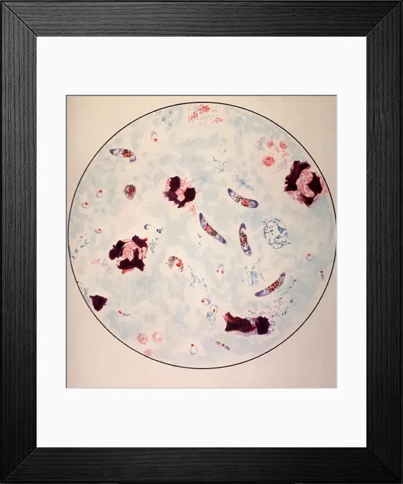 Framed Print : Microscopic view of a malaria parasite painted from microscopic view from a manual to assist in malaria diagnosis among U.S. troops serving in tropics during World War II. 1943