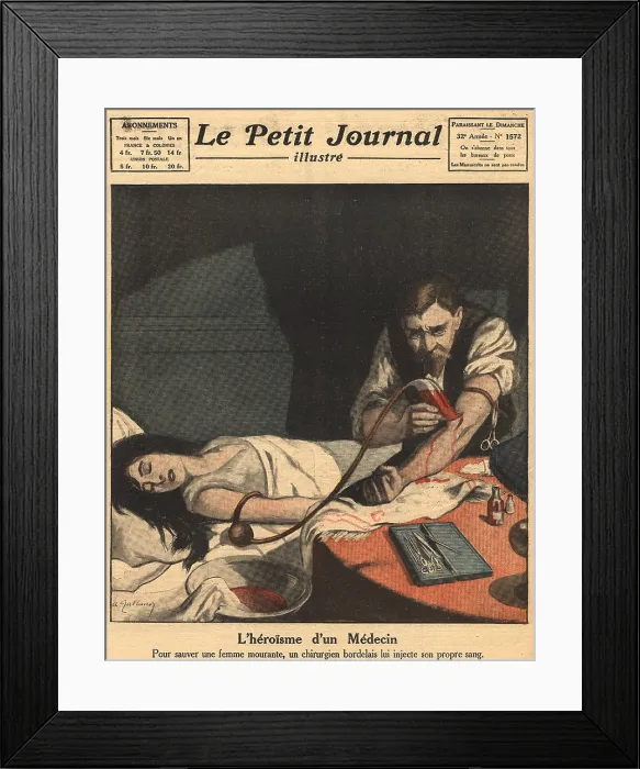Framed Print : 1921 Blood Transfusion. An unconscious woman receiving a blood transfusion directly from a doctor who injects her with his blood