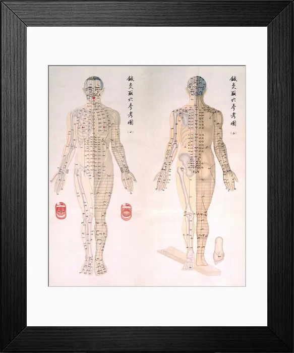 Framed Print : Chinese chart of acupuncture points on a male body, with bones are depicted on half of his body and muscles on the other half. Acupuncture points are noted all across the body
