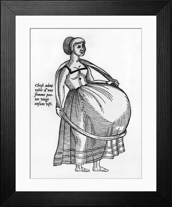 Framed Print : Pregnant woman using a hoop to support burgeoning womb. Illustration from a medical text by Ambrose Pare, the great French surgeon, 1575 Framed Print : Pregnant woman using a hoop to support burgeoning womb. Illustration from a medical text by Ambrose Pare, the great French surgeon, 1575
