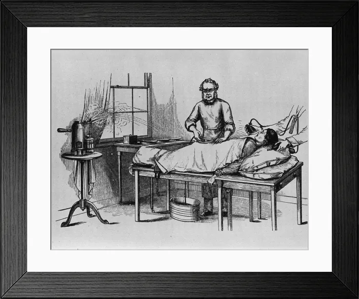 Framed Print : Doctor performing an ovariotomy, the removal of one or both ovaries, using anesthetic and antiseptic steam spray Framed Print : Doctor performing an ovariotomy, the removal of one or both ovaries, using anesthetic and antiseptic steam spray