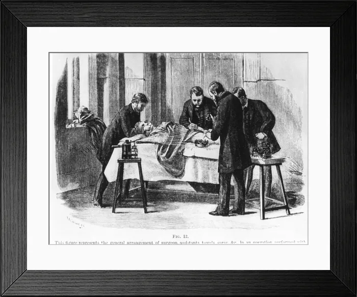 Framed Print : Operation performed with antiseptic precautions, using Lister carbolic acid spray