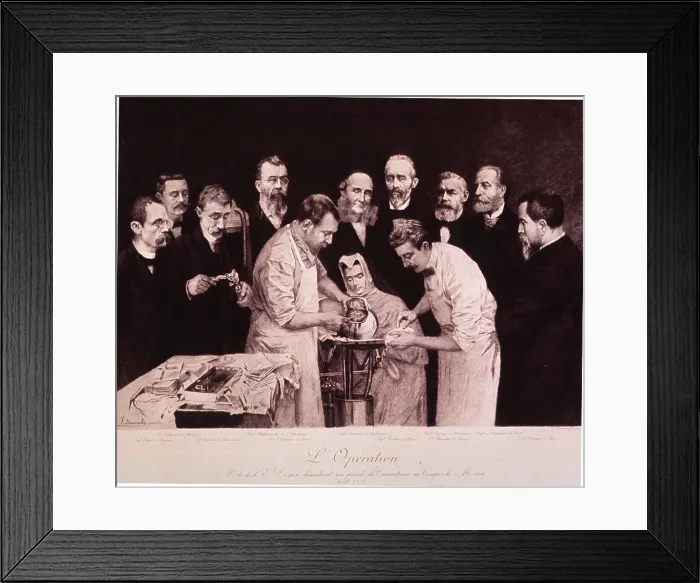 Framed Print : Eugene Louis Doyen (1859-1916), eminent French surgeon, performing craniotomy with aid of doctor and nurse while nine physicians observe