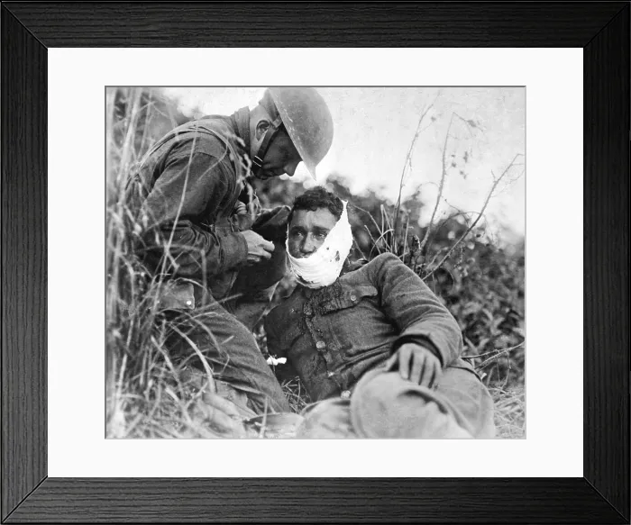 Framed Print : A just wounded American soldier, receiving first-aid treatment from a comrade. World War I. Varennes-en-Argonne, France. Sept. 26, 1918