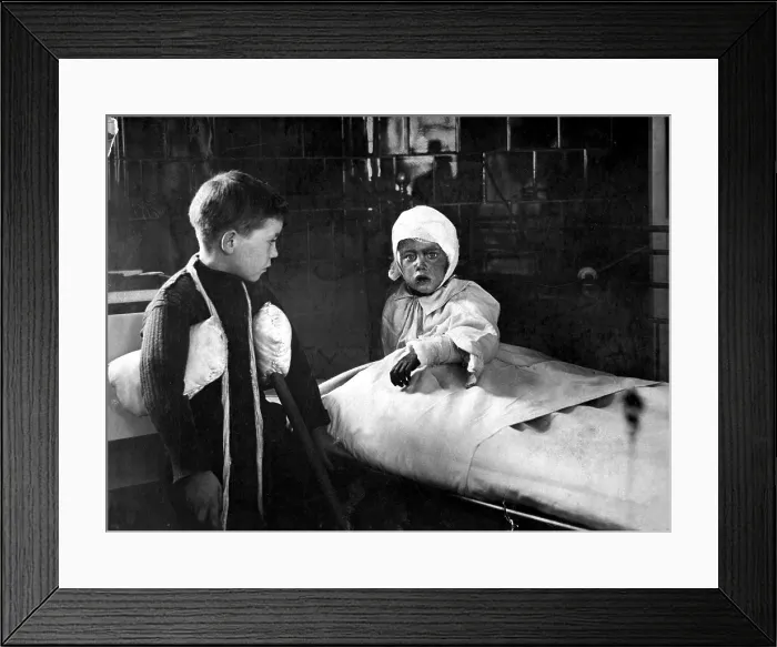 Framed Print : Wounded school children in a London hospital after a German World War I air raid. Ca. 1915 Framed Print : Wounded school children in a London hospital after a German World War I air raid. Ca. 1915