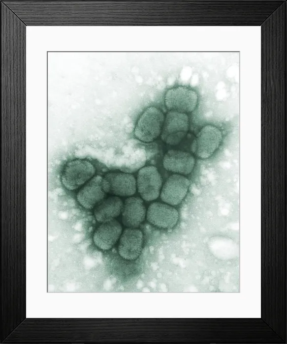 Framed Print : Smallpox viruses. A colorized transmission electron micrograph. 1975 Framed Print : Smallpox viruses. A colorized transmission electron micrograph. 1975