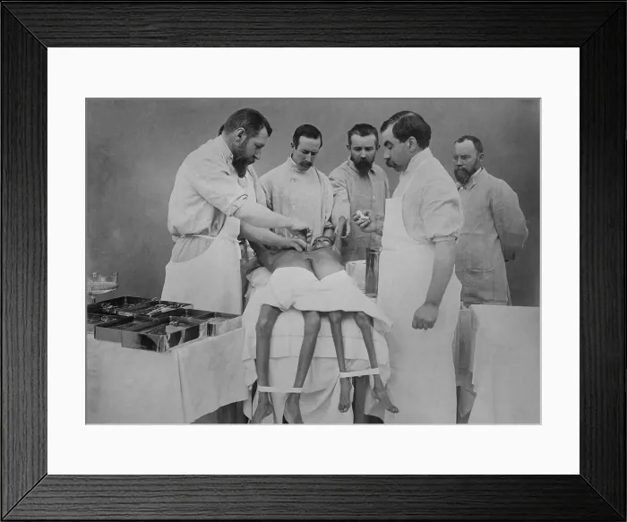 Framed Print : 1912 operation separating young Indian conjoined twin sisters, Radica & Doodica, by famous French surgeon, Eugene-Louis Doyen (1859-1916) is at far left Framed Print : 1912 operation separating young Indian conjoined twin sisters, Radica & Doodica, by famous French surgeon, Eugene-Louis Doyen (1859-1916) is at far left