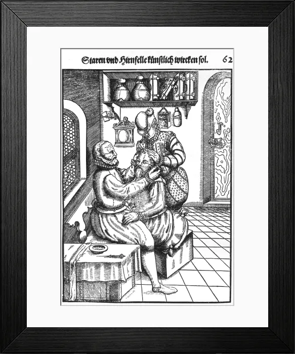 Framed Print : Patient having a cataract removed from his left eye by a surgeon whose assistant immobilizing the patient Framed Print : Patient having a cataract removed from his left eye by a surgeon whose assistant immobilizing the patient