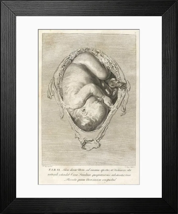 Framed Print : Fully developed human fetus in utero. Engraving from William Hunter's THE ANATOMY OF THE HUMAN GRAVID UTERUS, 1774