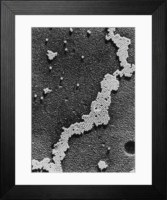 Framed Print : Polio (Poliomyelitis) virus, the cause of Infantile Paralysis, was discovered in 1908 by Karl Landsteiner