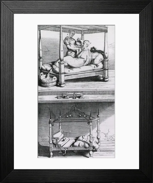 Framed Print : Fever Bag of the 17th century